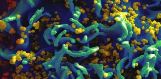 Celula-T-infectata-cu-HIV